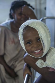 Medecins Sans Frontieres treat severe burn victims in Haiti