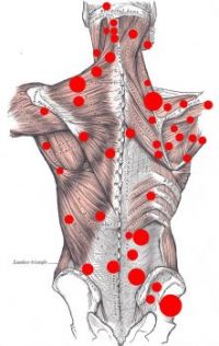 Pressure points