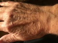Hand of an 81 year old man I know