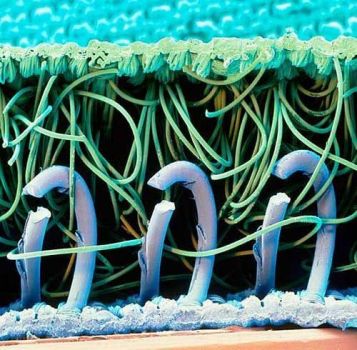 Magnified Velcro