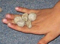 Collect small stones and play a game something like "Jax" - toss them up, turn over hand and catch a certain number in your palm before they reach the ground.