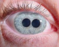 eye with two iris (2)