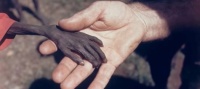 starvation